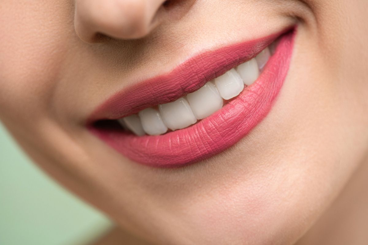A bright, healthy smile after professional whitening